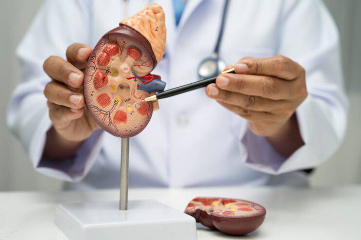 Kidney Stone Symptoms: 7 Warning Signs You Should Never Ignore